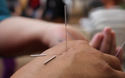 Acupuncture: A Holistic Approach to Pain Management and Well-being